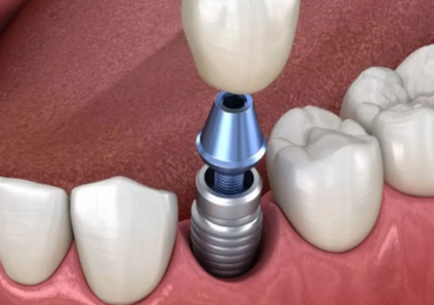 道縣牙科醫(yī)院口碑好的有哪些