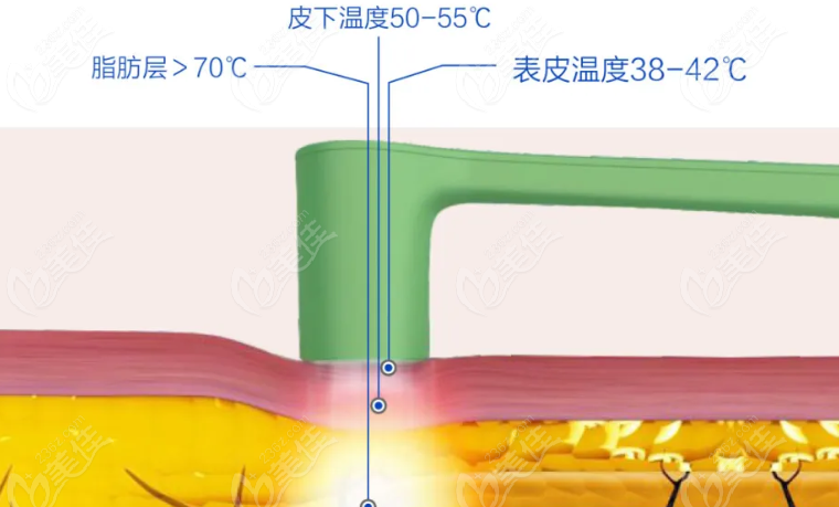 陈旭华医生擅长项目