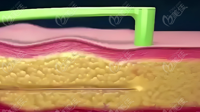 陈旭华医生审美