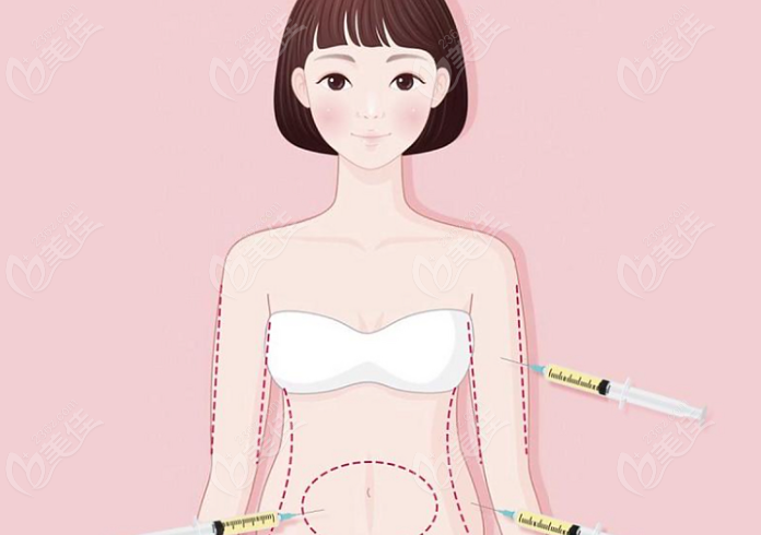 身体吸脂：个性化塑形