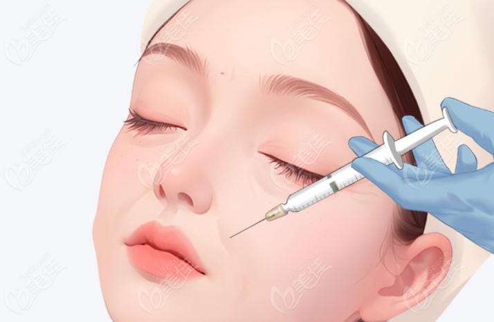 玻尿酸填充：艺术填充，提升面部年轻态