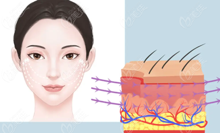 韧带筋膜复位 韧带筋膜复位