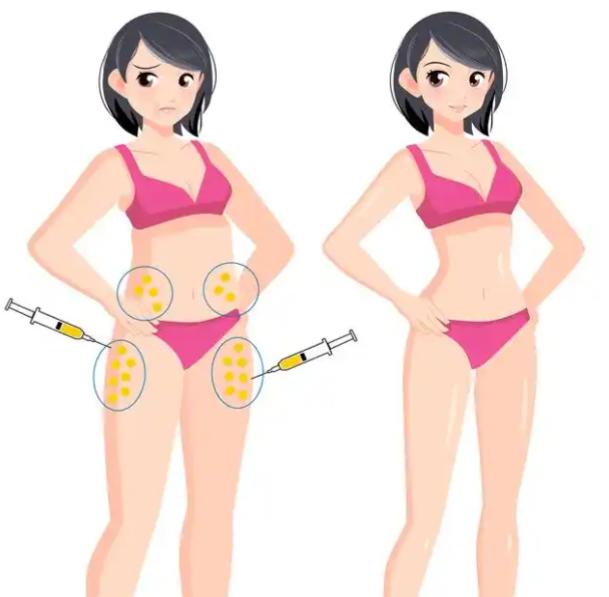 钟伟洪医生抽脂收费