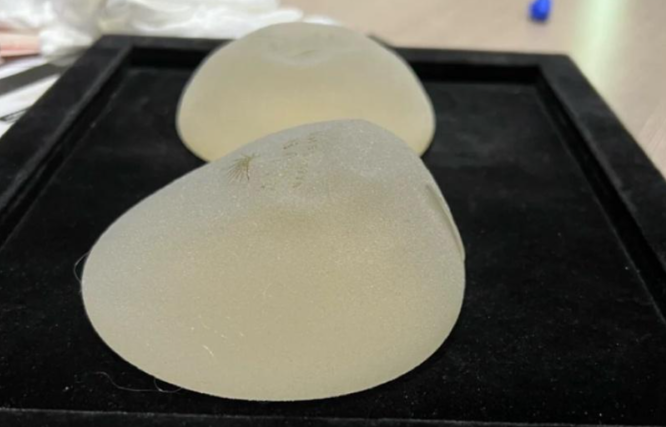 先了解傲诺拉假体系列