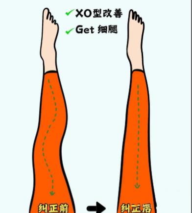 卢九宁多维直腿术有啥内容