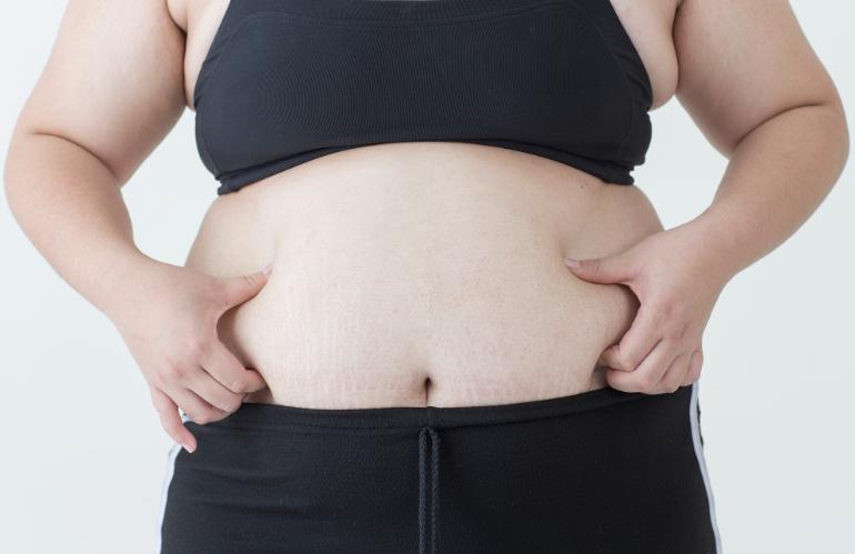 钟伟洪医生吸脂怎么预约