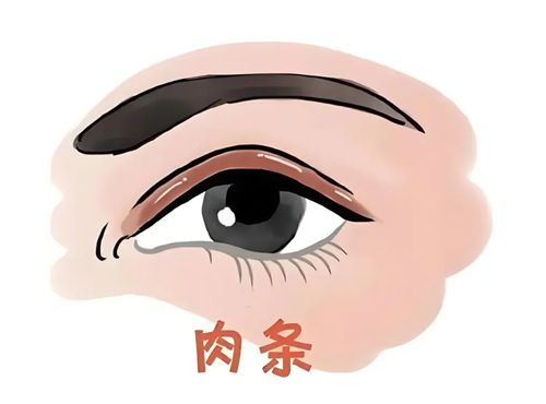 吕瑛医生凭啥能成肉条眼修复“王牌”