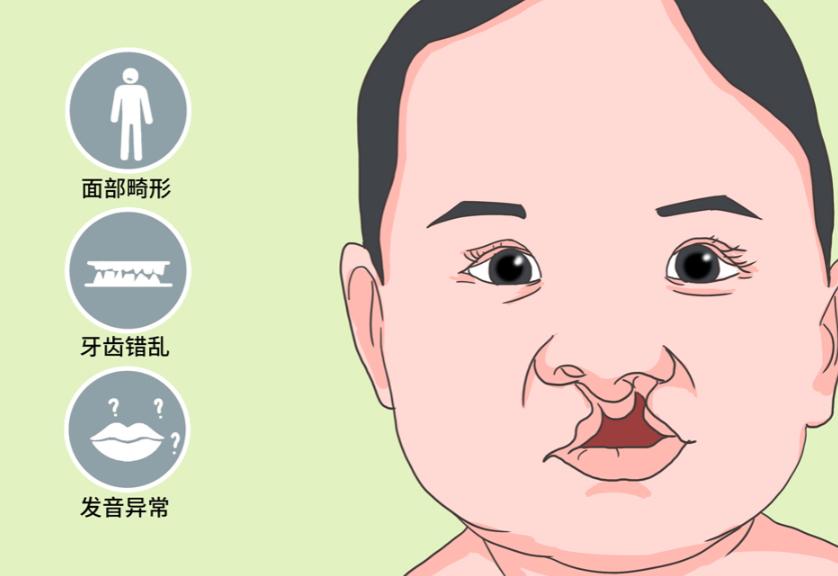 孙来东做唇裂修复怎么样