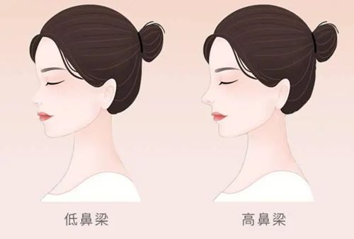 深圳張輝赫本鼻靠譜嗎