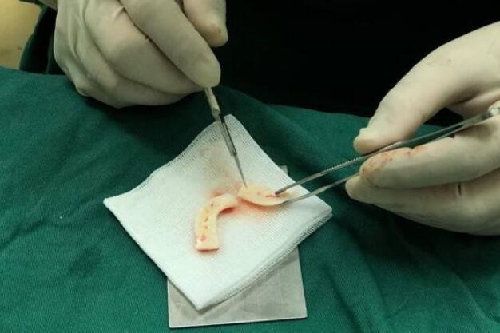 為啥說(shuō)張輝的赫本鼻“基本不用修”