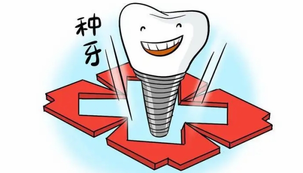 旬陽牙科種植牙價(jià)格