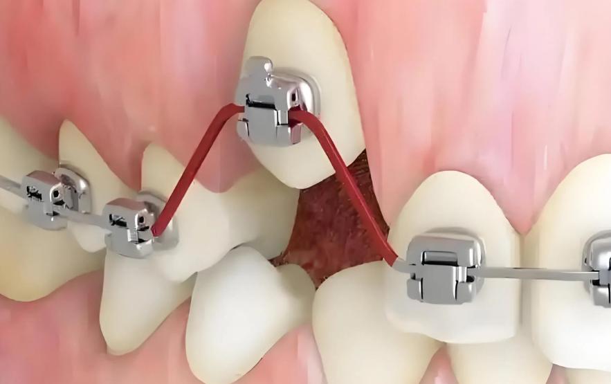 中科領(lǐng)軍口腔醫(yī)院靠譜正畸醫(yī)生名單：10位常見醫(yī)師基本情況