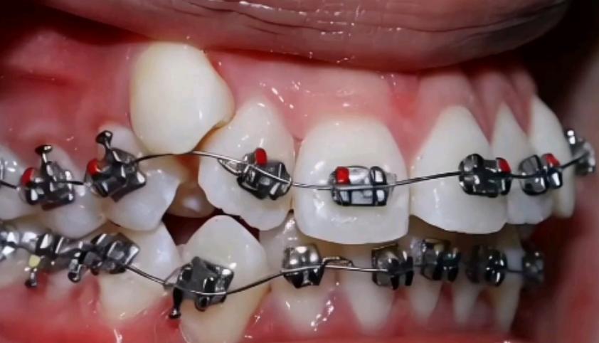 中科領(lǐng)軍口腔醫(yī)院分院正畸醫(yī)生：草橋/清河等5分院12位同步推薦