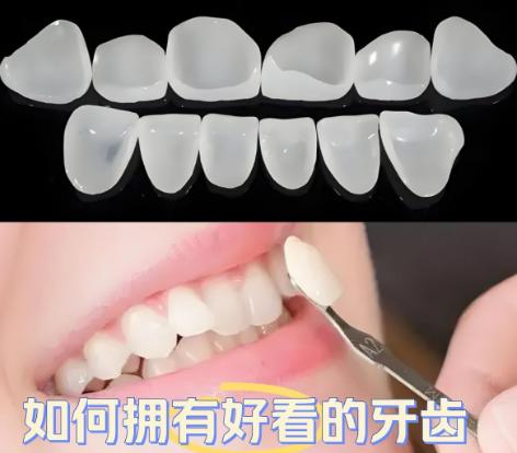 北京中諾牙齒貼面的療效體驗(yàn)：瑞士義獲嘉超薄貼面技術(shù)