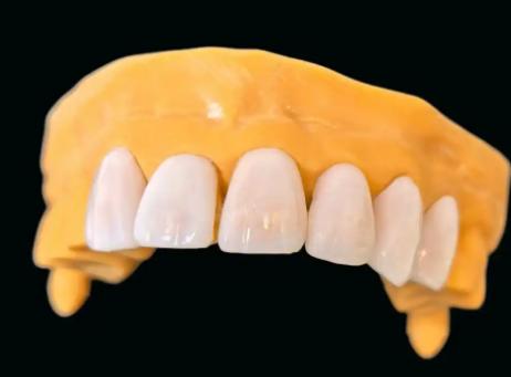 北京中諾牙齒貼面的醫(yī)生團(tuán)隊(duì)：哪些醫(yī)生做貼面更讓人放心？