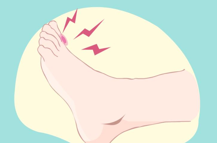 圣嘉新治疗拇外翻哪位大夫做的好