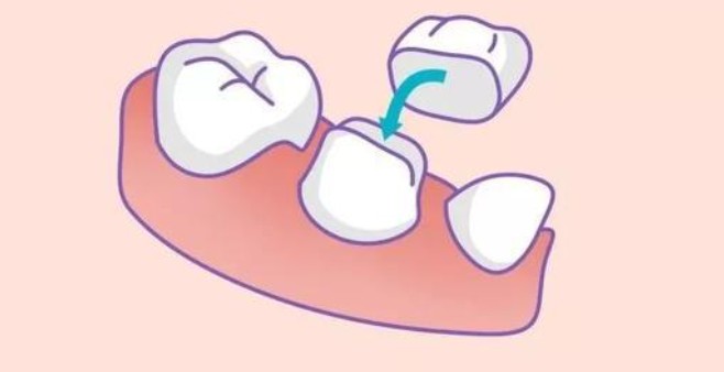 二、安康鑲牙醫(yī)院詳細介紹m.pfflawyer.com