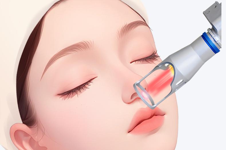 張賀人中縮短技術(shù)要點(diǎn)與適應(yīng)人群