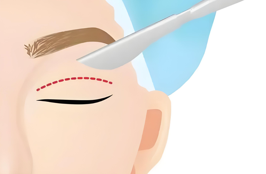 成都米蘭柏羽和銅雀臺(tái)就診體驗(yàn)差異