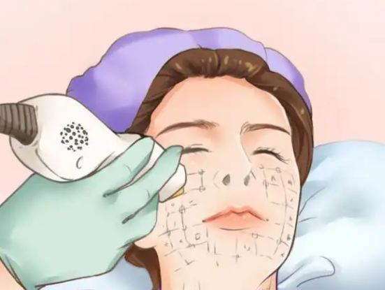 深圳超声炮项目介绍