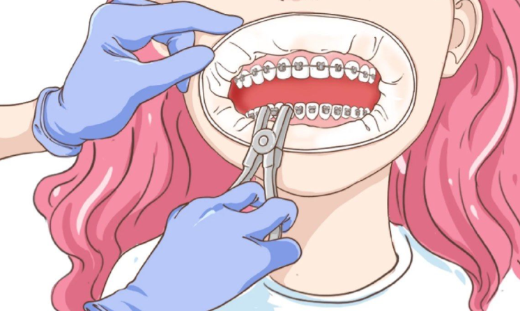 正畸正頜聯(lián)合治療具體價(jià)格表