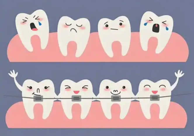 正畸正頜聯(lián)合治療