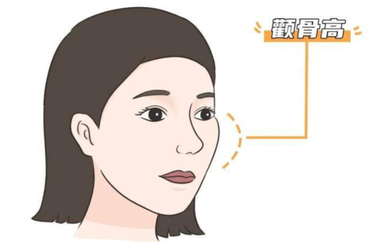 深圳颧骨内推医生排名