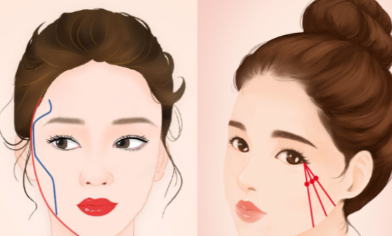 深圳有名颧骨内推医生排名