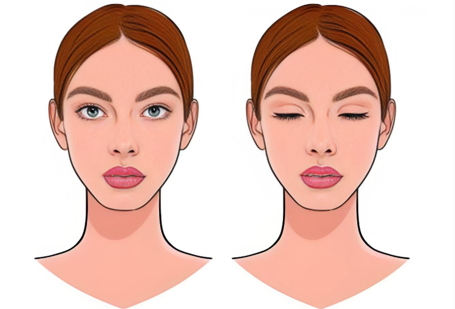 深圳颧骨内推手术项目分析