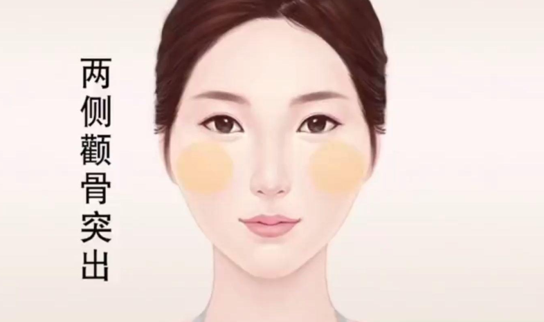 深圳颧骨内推综合对比与就医选择路径