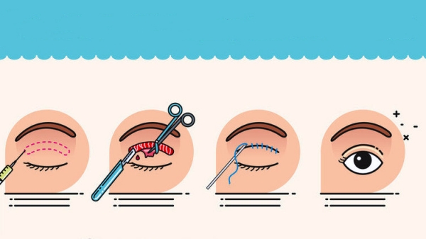 上海于晓雪眼修复