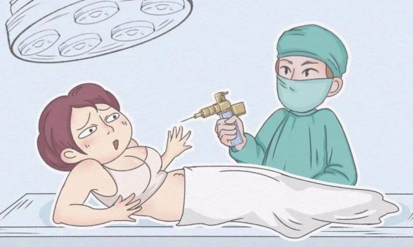 郑州杨柳医生吸脂价格