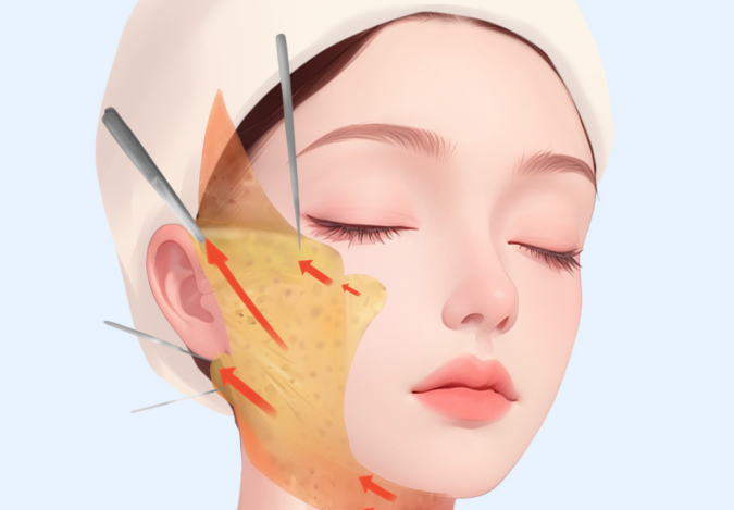 联合丽格和八大处哪个好：面部提升技术对比