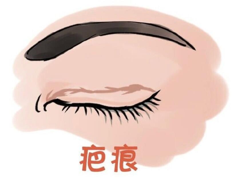 上海花金环医生修复眼睛做得好