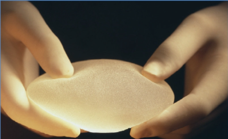 用威宁之星假体