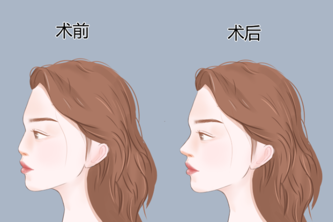 10位親測(cè)者反饋：包國(guó)宏做鼻子的真實(shí)滿意度情況
