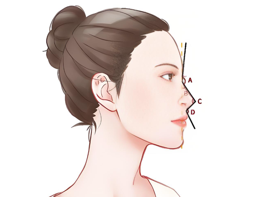 周俊杰上海隆鼻多少钱