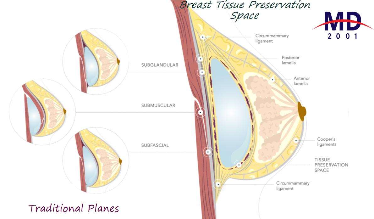上海李海涛对包膜管理的重视