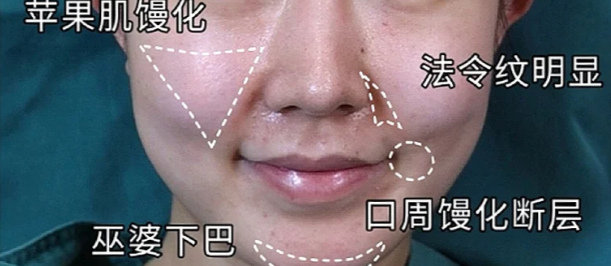 朱慧东博士馒化修复经验