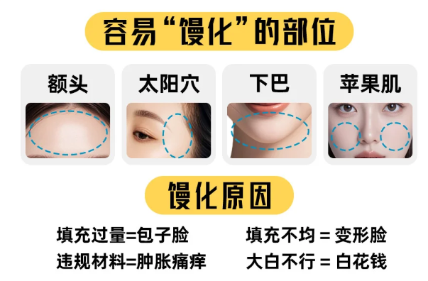 朱慧东博士馒化修复术后护理重点：5项核心要点要记牢