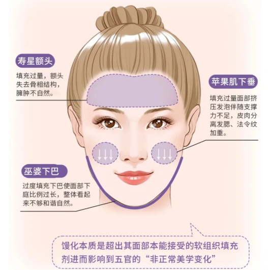 朱慧东博士馒化修复真实实例：30天从“馒化脸”到“自然脸”