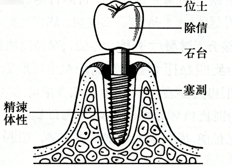 佛山爱顿口腔就诊攻略