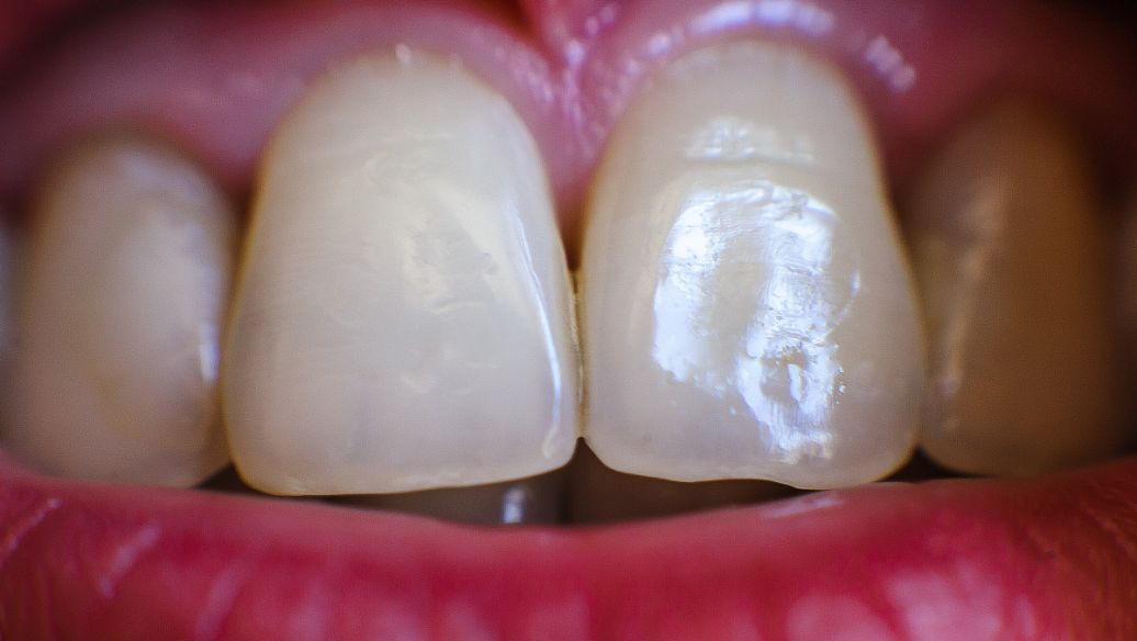 沙井牙科诊所不同项目的医院选择流程