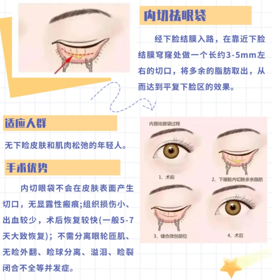 按需选择较合理