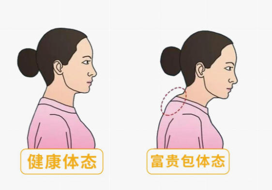 乌鲁木齐哪家做富贵包手术做得好 - 总结
