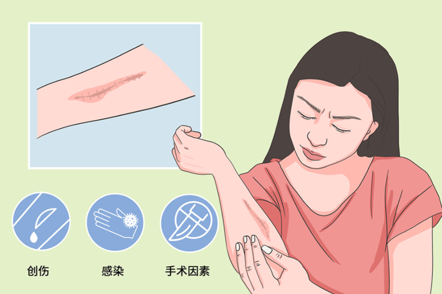 成都潤(rùn)禾皮膚病專科醫(yī)院實(shí)用信息+總結(jié)