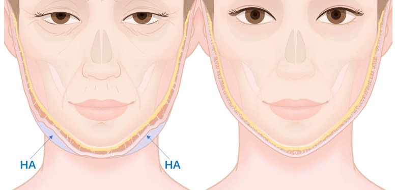 理性选择建议:什么样的人适合选他?避开这些坑