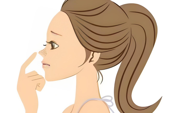 郑州集美张海洋隆鼻技术