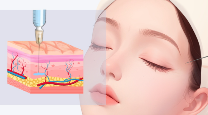 西安卢丙仑做脂肪填充技术