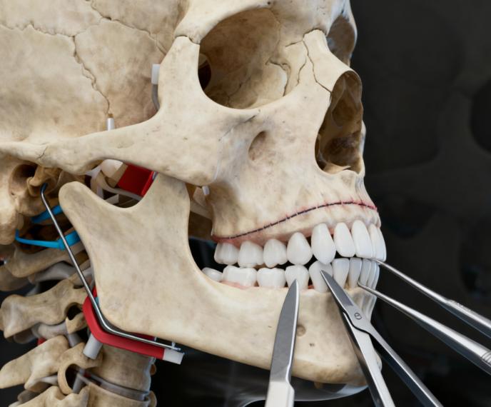  技術(shù)演進：從“一刀切”到“L型留角”，追求自然的蛻變